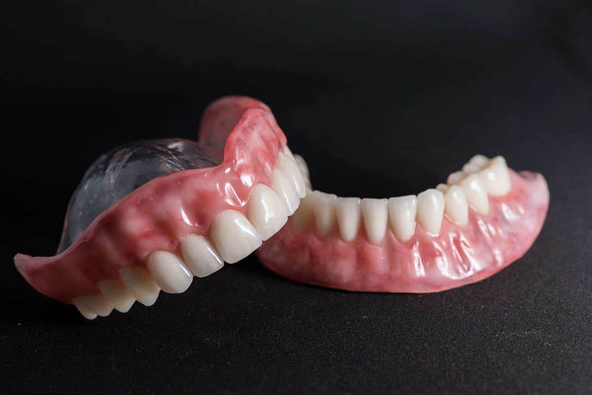 aston dental MERCURY FREE RESTORATION (TOOTH COLOURED FILLING)